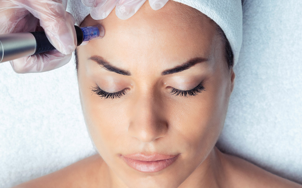 Μη ενέσιμη μεσοθεραπεια με dermapen